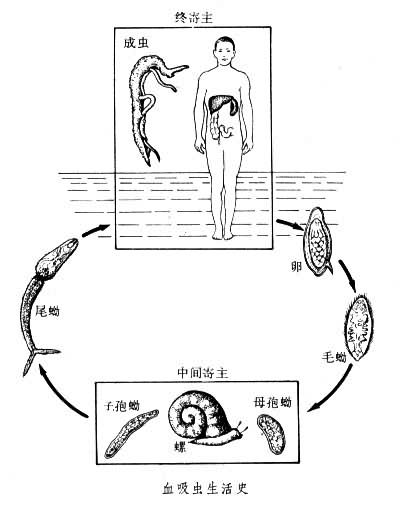 血吸虫病