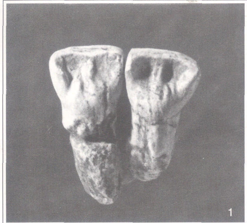 1.元谋人牙齿化石