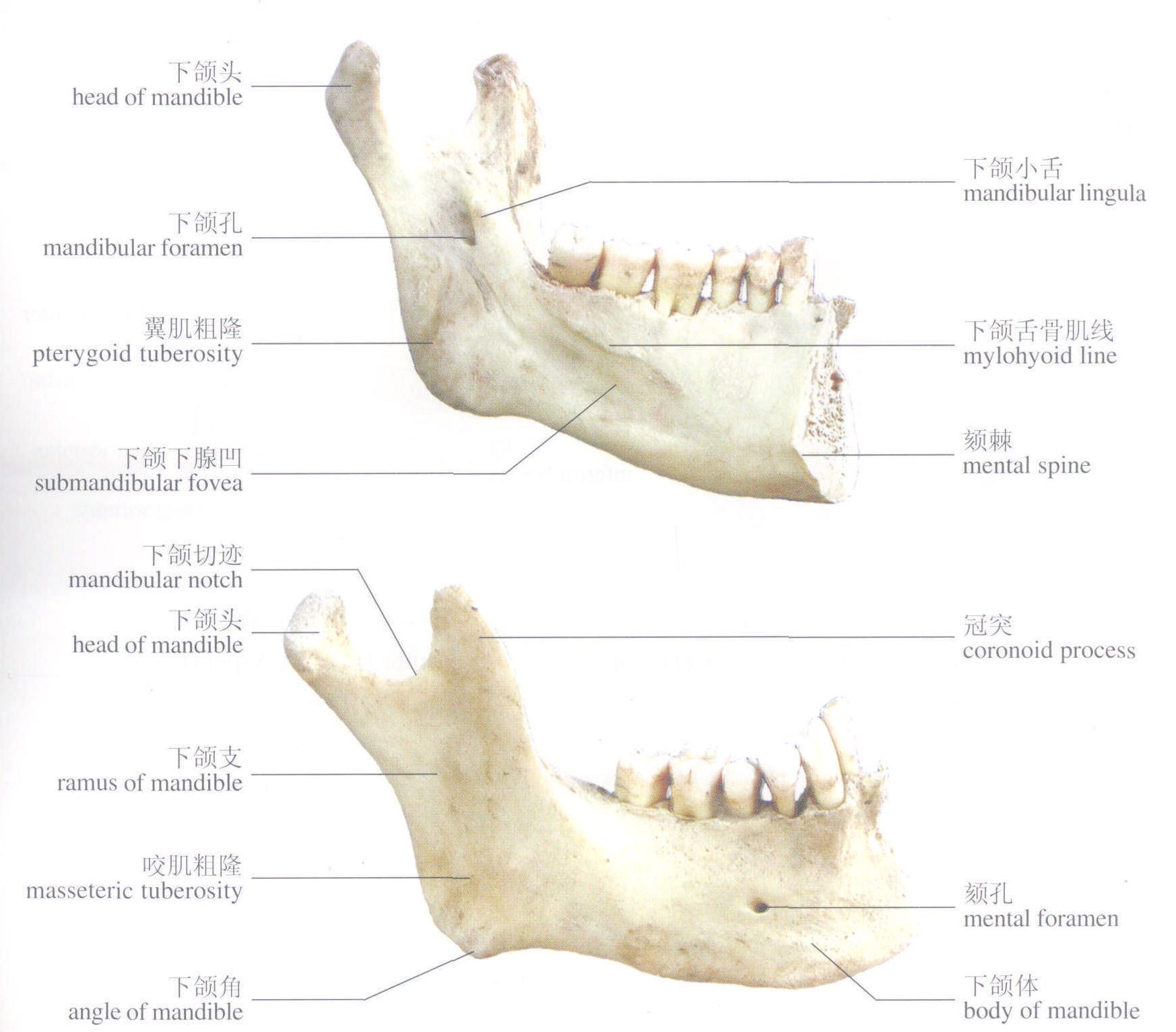 上颌骨(内面观)-人体解剖标本-医学