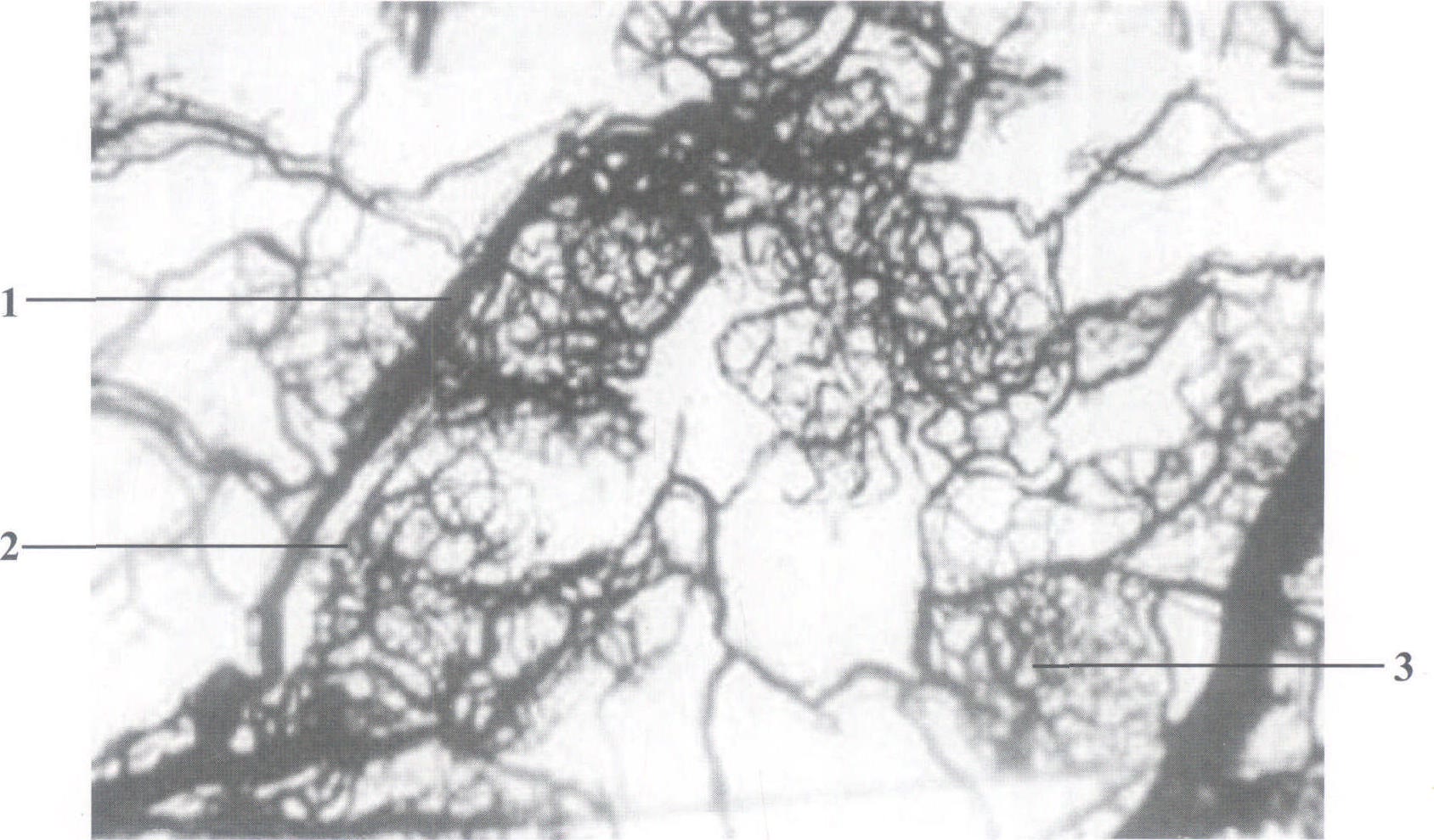 圖1-6 淺筋膜血管網(wǎng)(透明標(biāo)本，3.2×4)