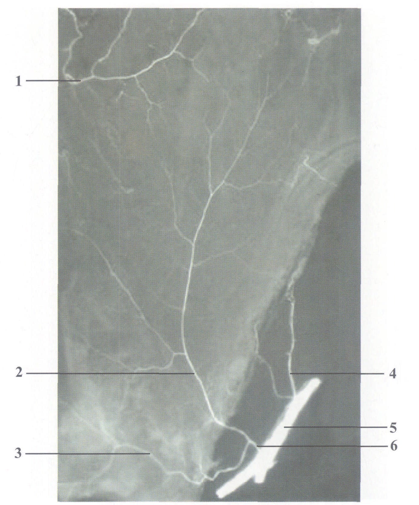 femoral artery图片