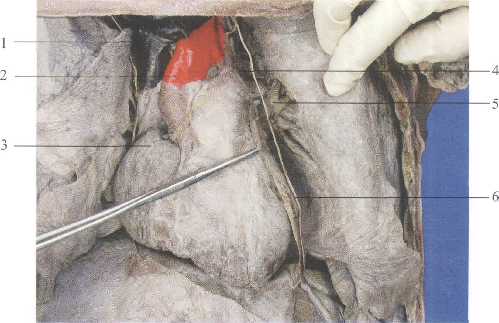 图1-7 左肺根前面观(成人)