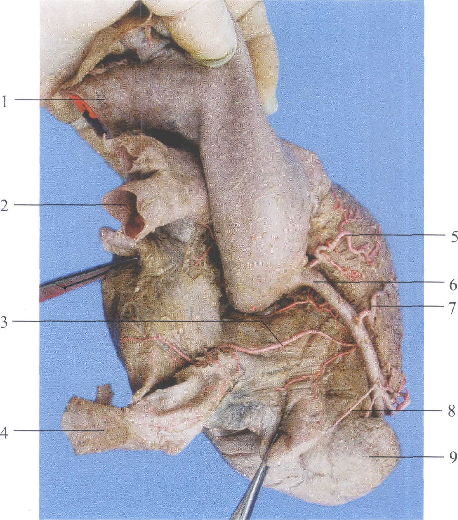 图3-3 心房动脉(右心房上面观)