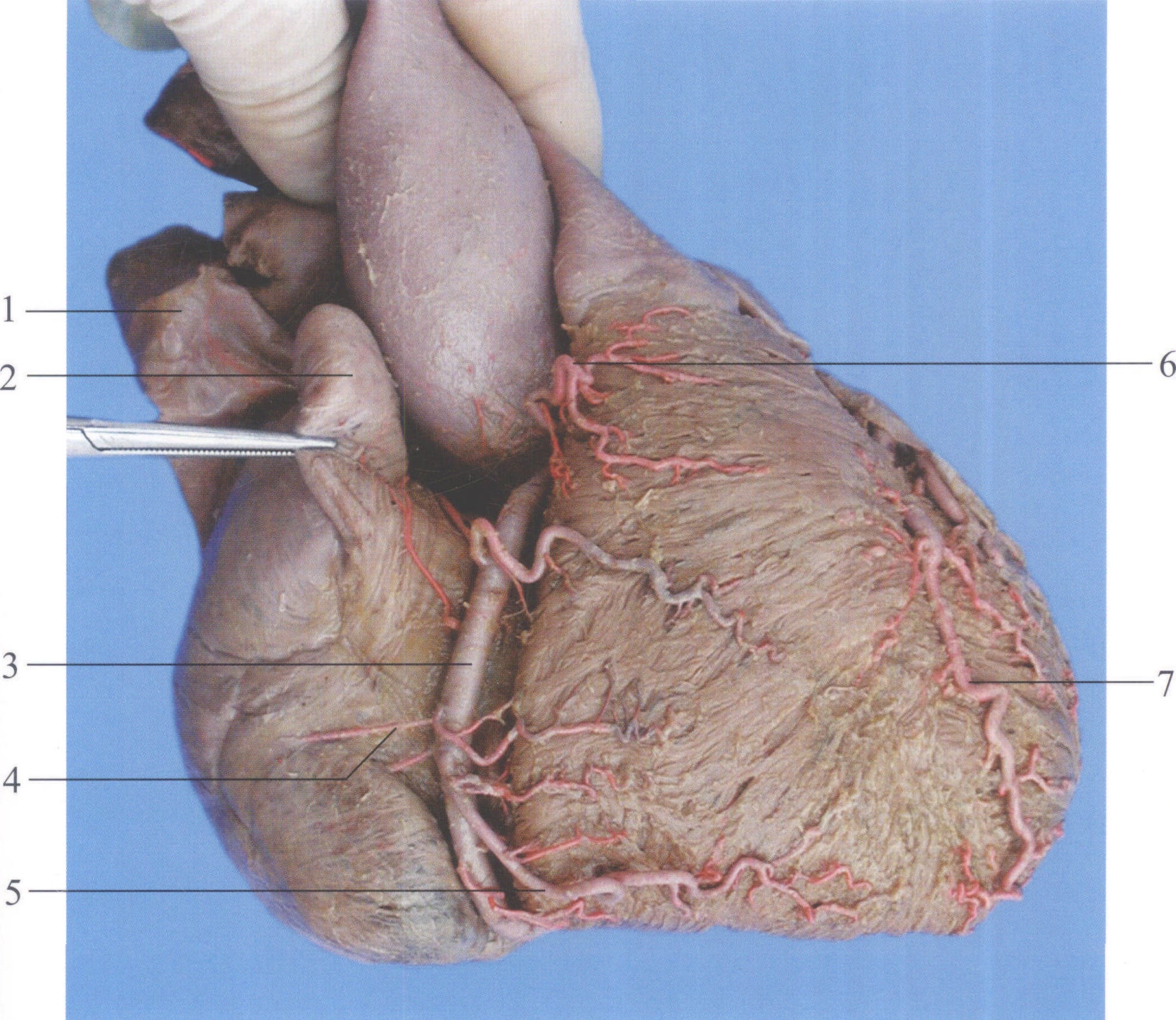 图3-6 心房动脉(右心房前面观)