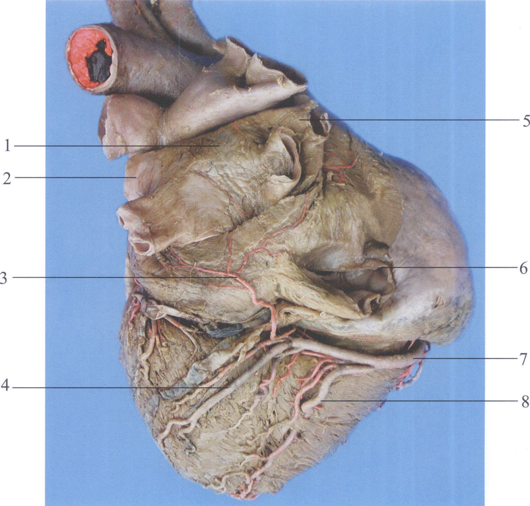 图3-8 心房动脉(左心房后面观)