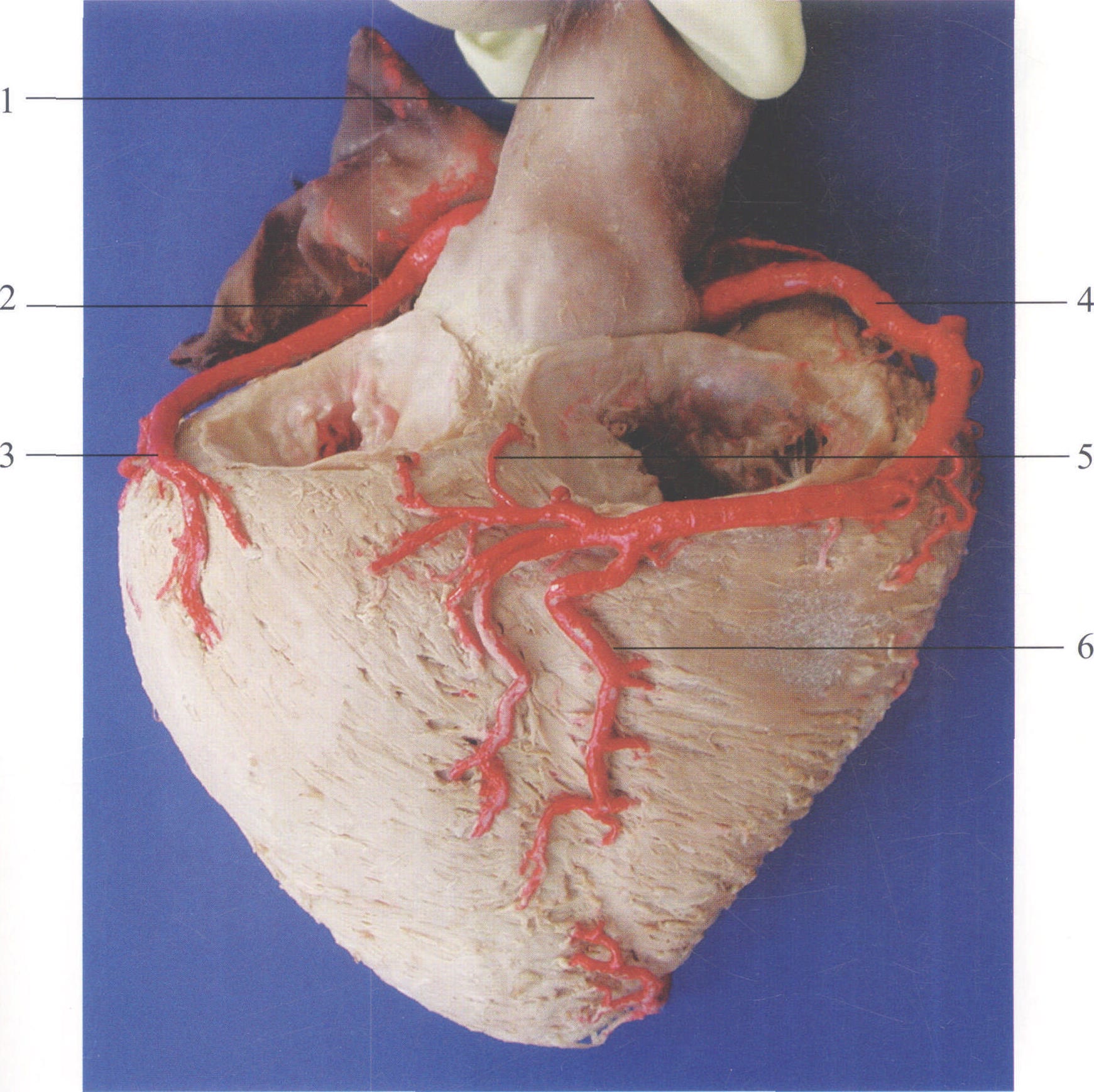 图3-10 右冠状动脉(心房已切除)