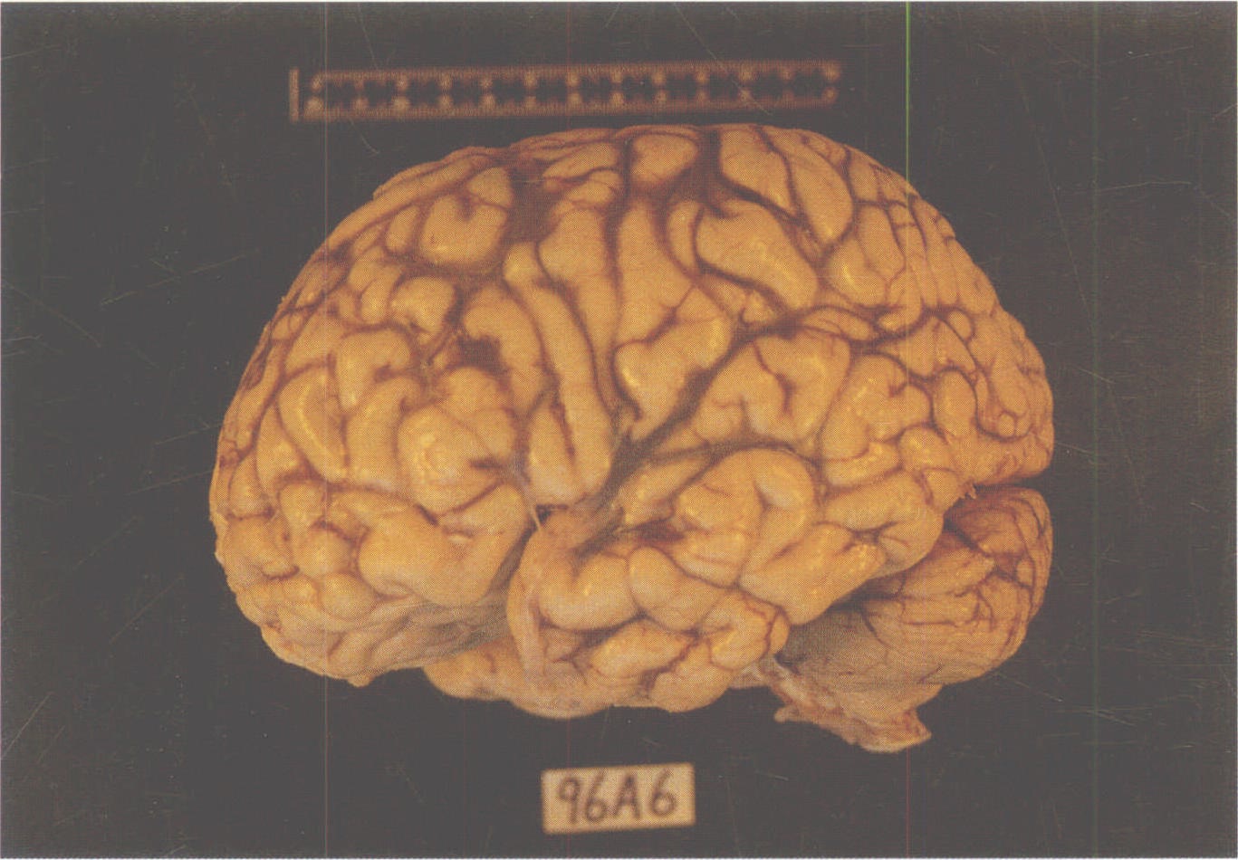 图1-2 人脑的侧面观，示左侧额、顶、颞、枕脑叶和小脑