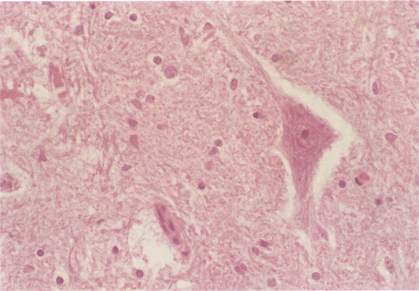 图1-9 神经元及周围散在的胶质细胞。HE染色，中倍
