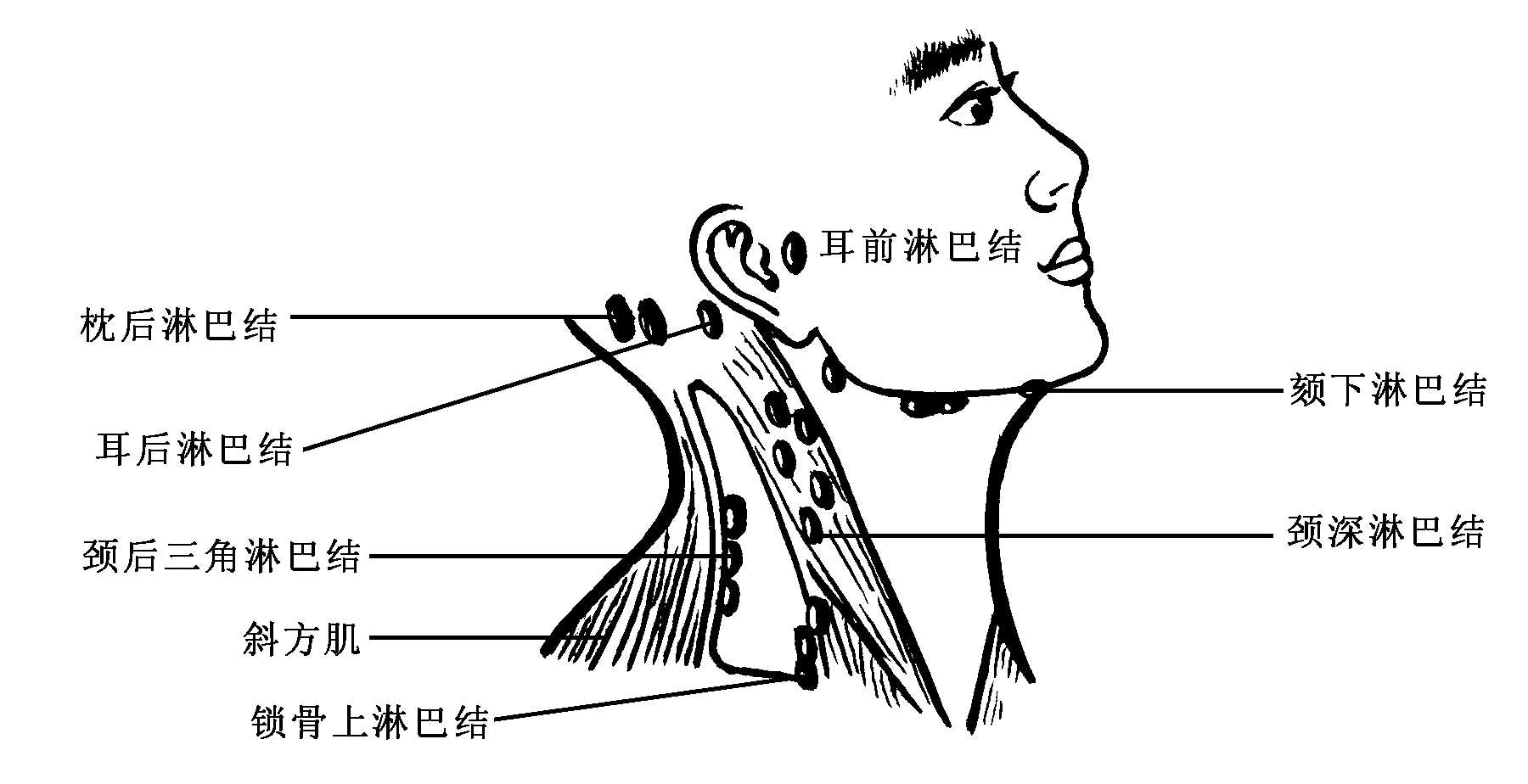 第三節(jié)、淋巴結(jié)檢查