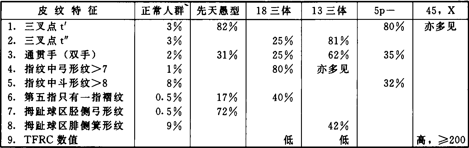 皮纹与染色体病