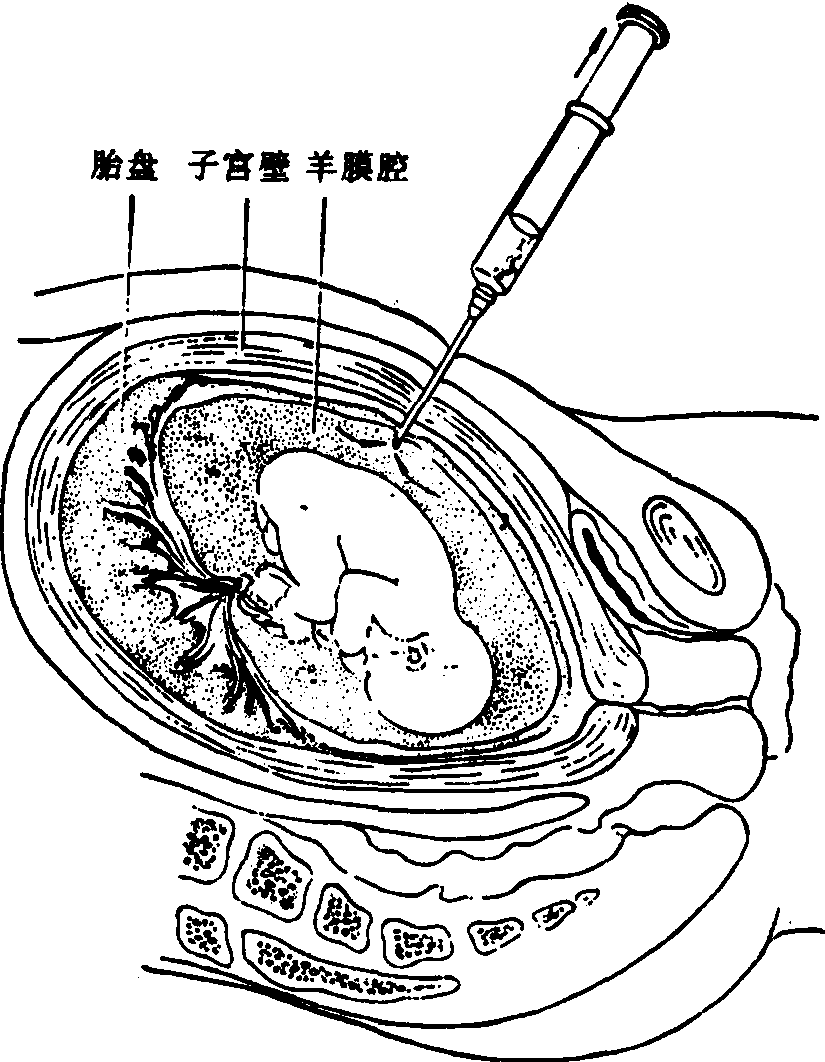 羊水存在于羊膜腔内