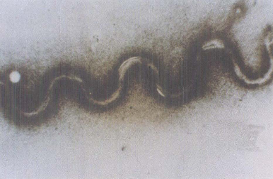 梅毒螺旋体的形态及其特殊染色