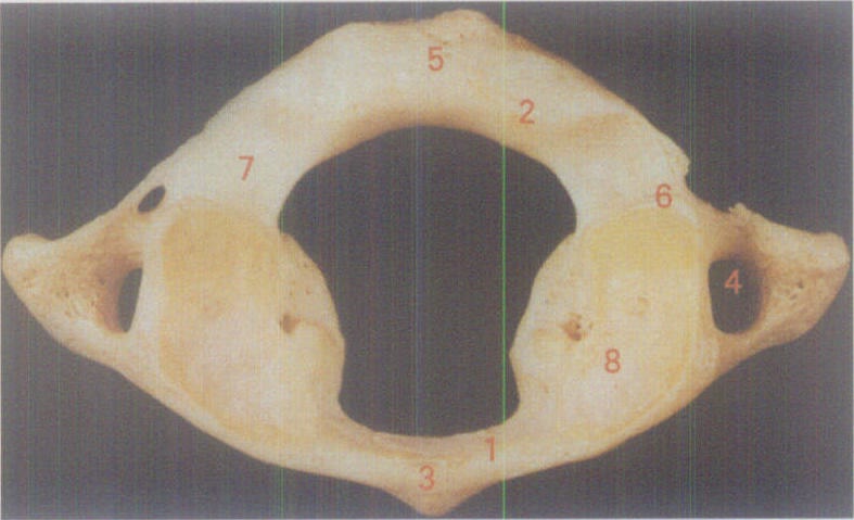 图1-4　寰椎