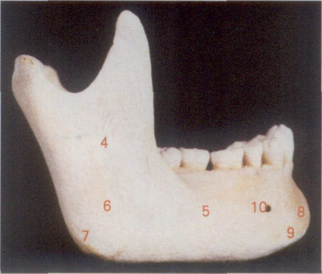 图1-25　下颌骨外侧面和儿童下颌骨