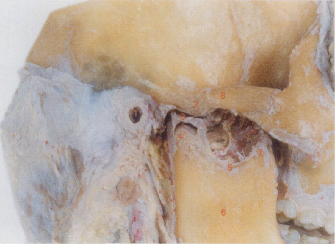 upper mandible图片