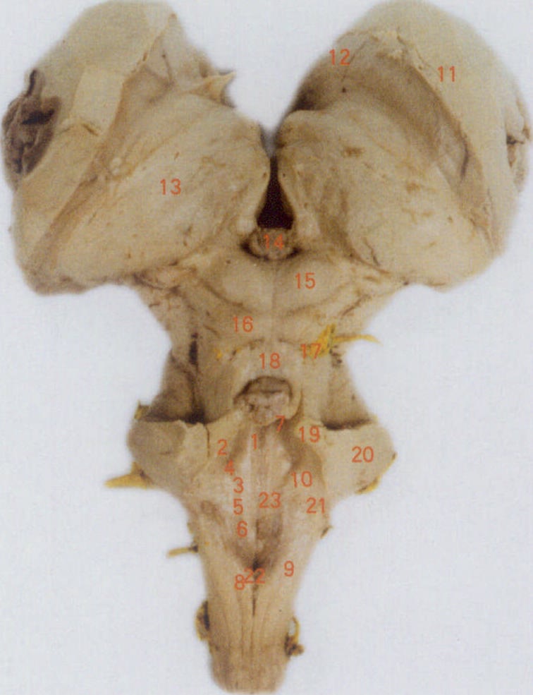 脑干背侧面图片