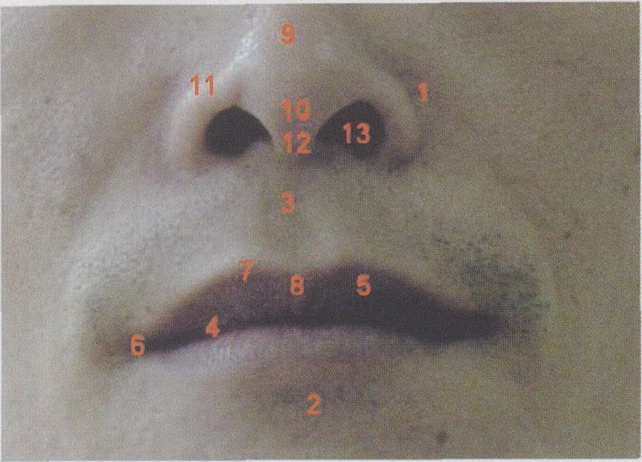 图1-1 口唇和外鼻