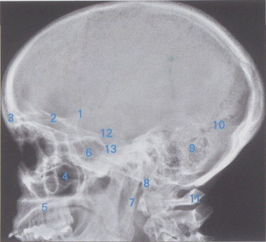 图1-19 颅骨侧位像