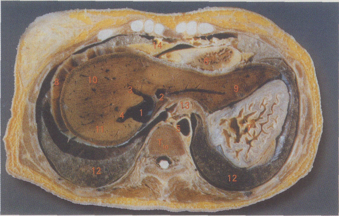 第二肝门横断面图片