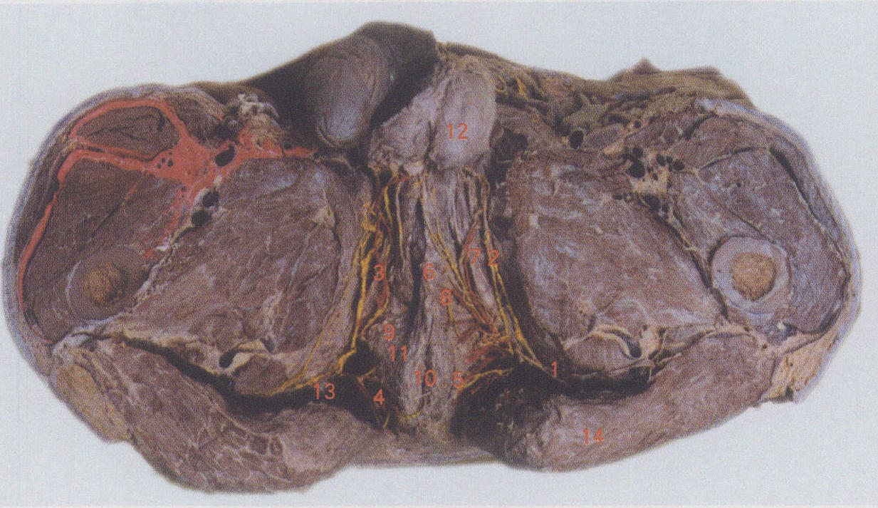 阴囊标本活体图片