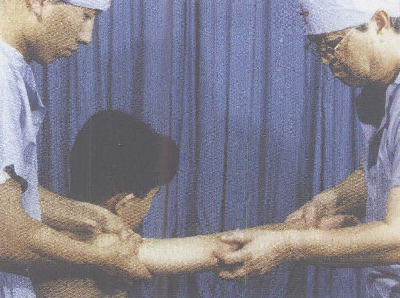第九節(jié) 尺骨鷹嘴骨折
