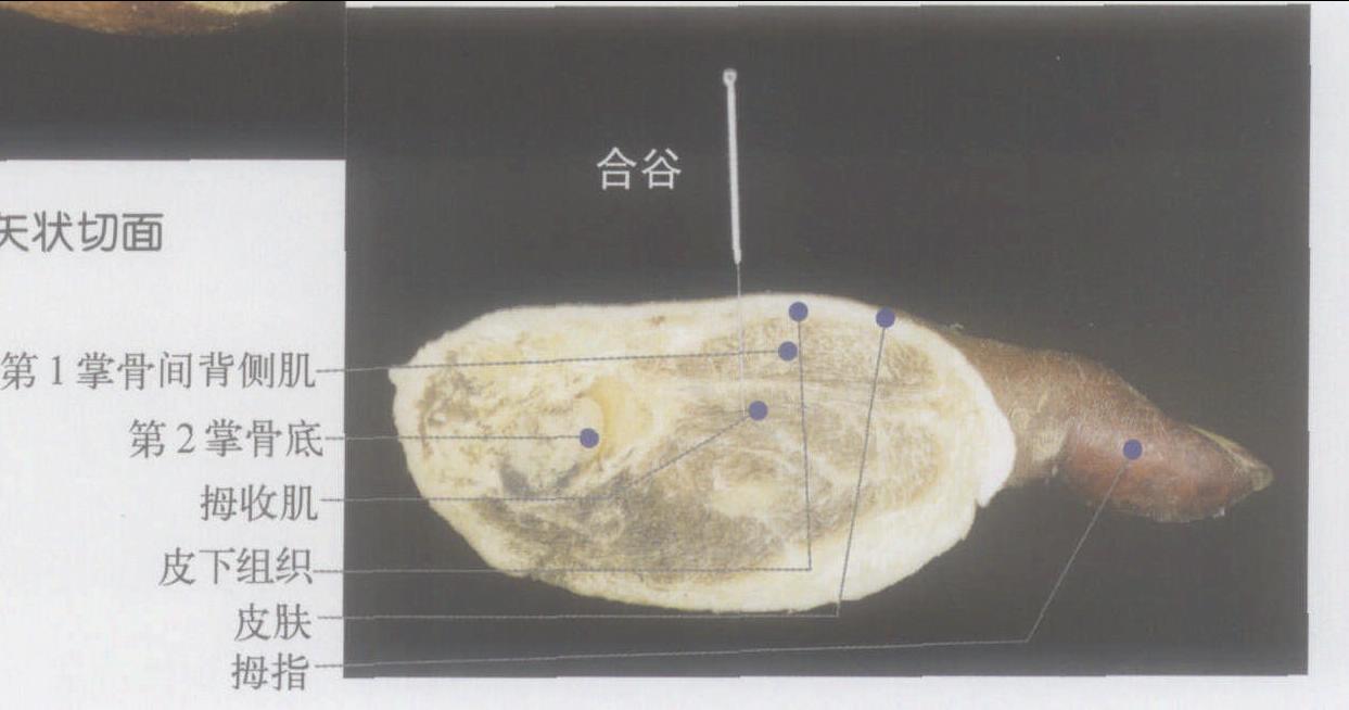 圖3-4(2)左合谷穴矢狀切面
