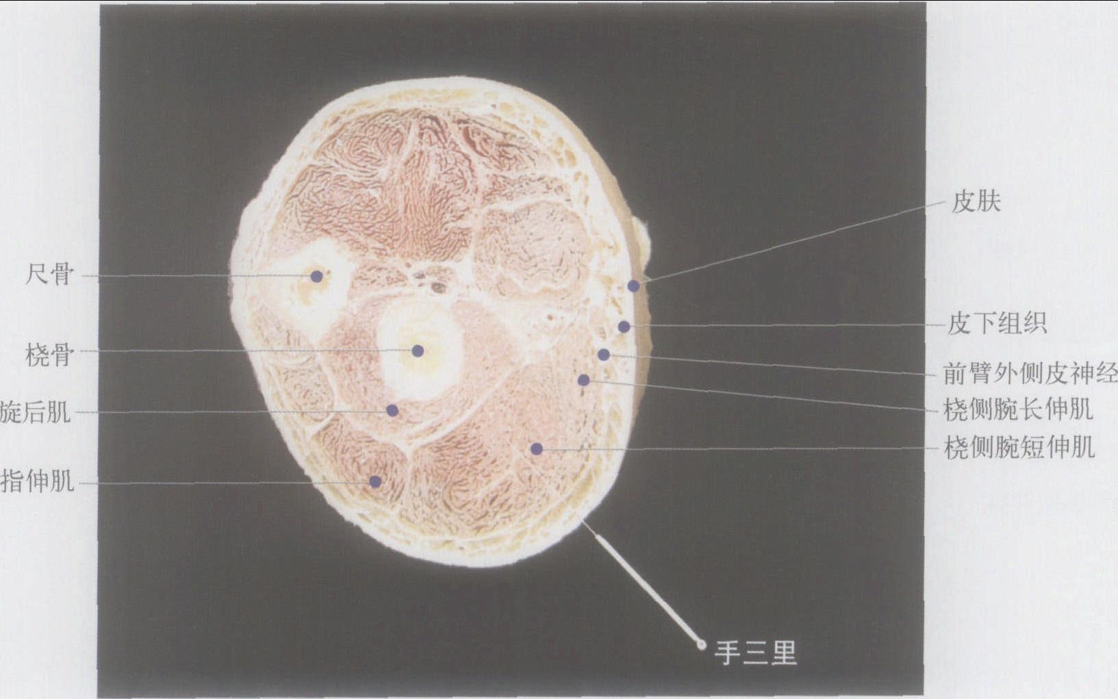 (图) 右手三里穴横切面