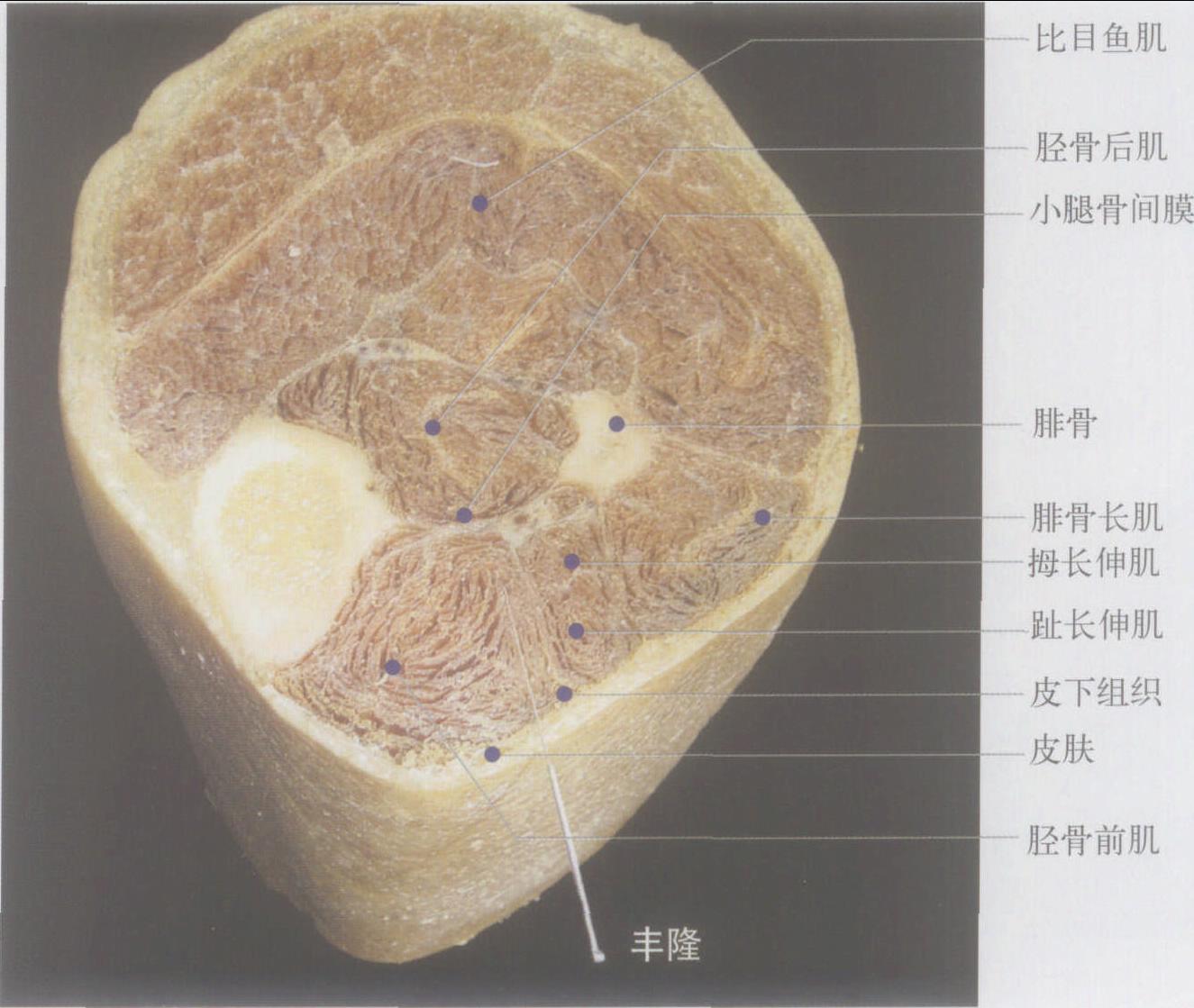 侧脑骨丰隆贵不可言图片