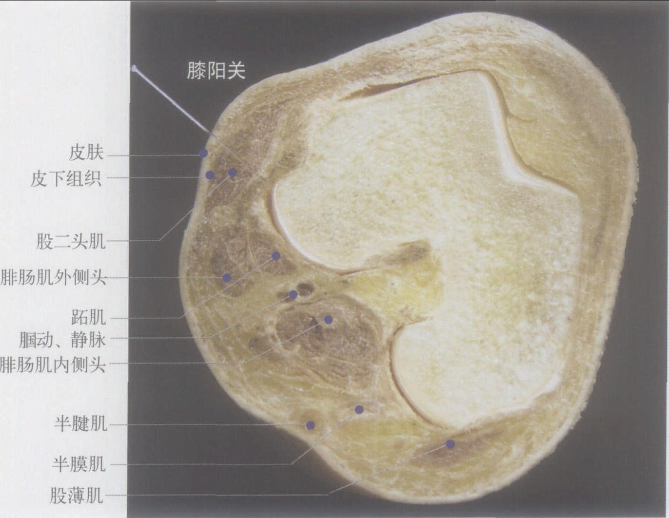 膝阳关图片