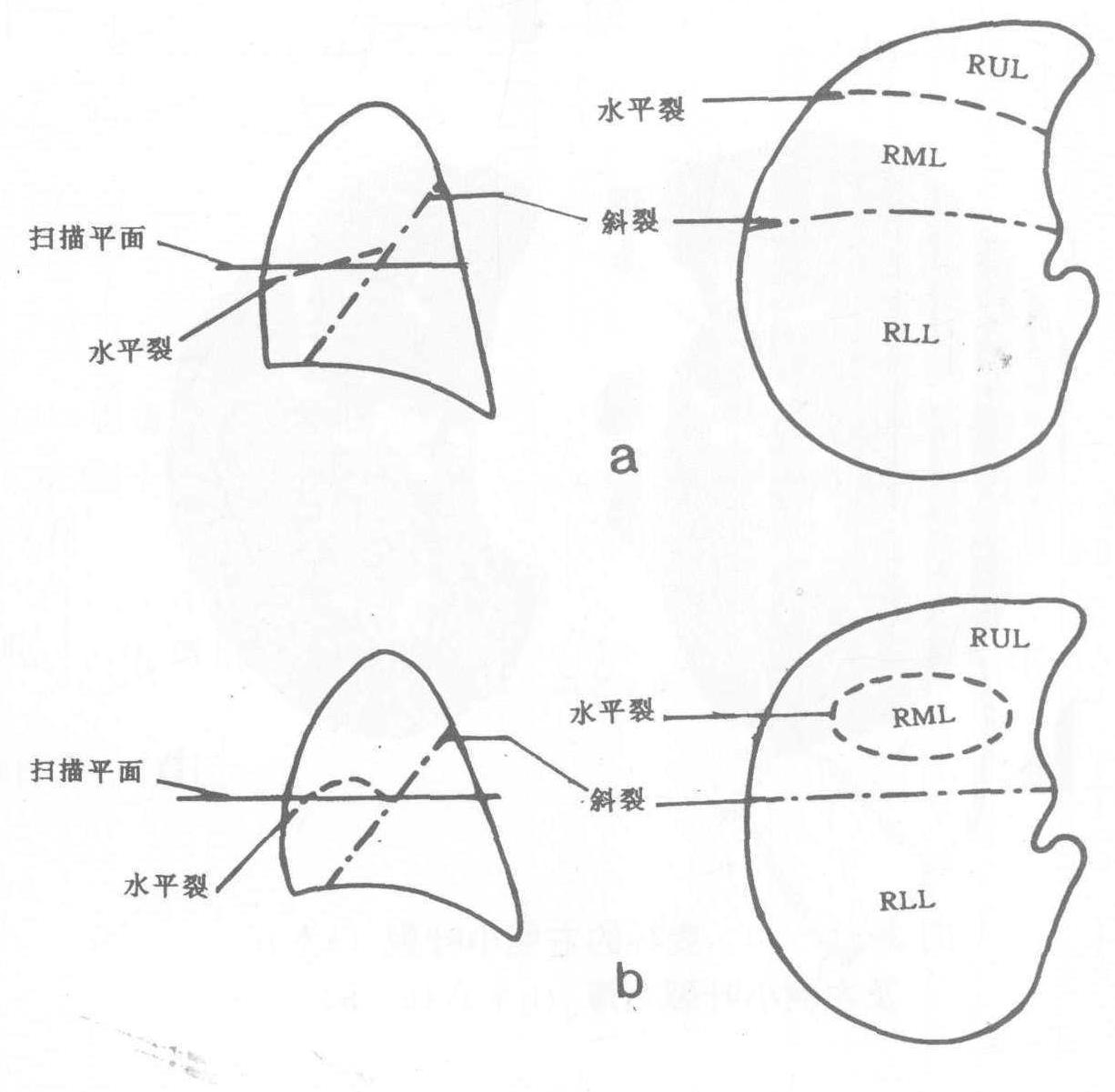 八、膈神經(jīng)