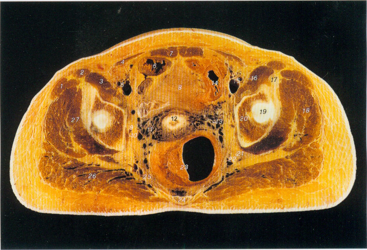图88经尾骨和子宫颈的横断层