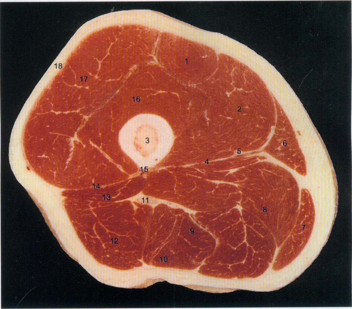 股直肌rectusfemoris2股内侧肌vastusmedialis3