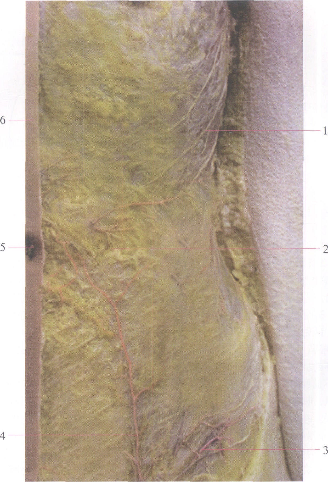 图2-1 腹前外侧壁浅筋膜