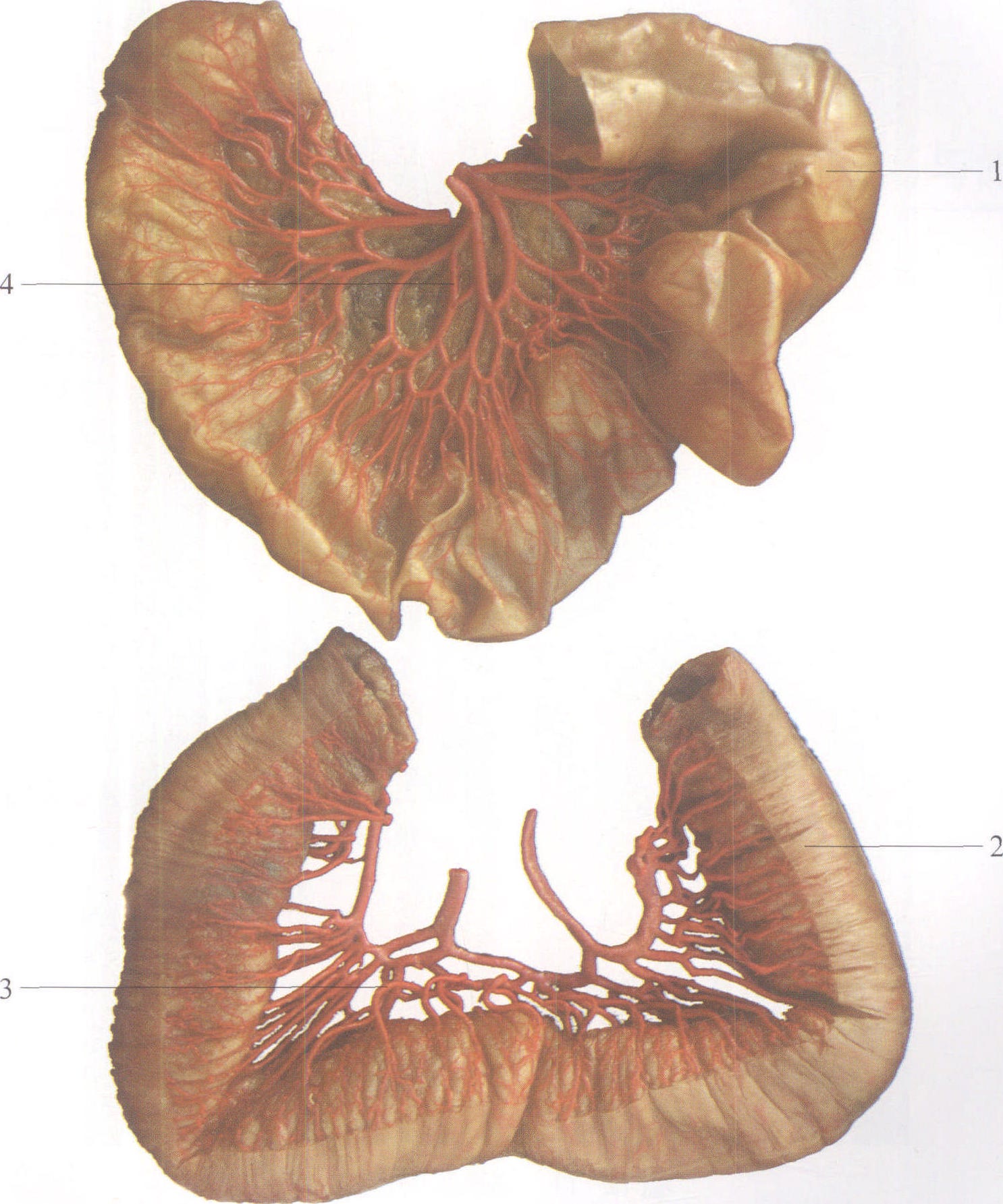 图12-10 空、回肠的动脉弓