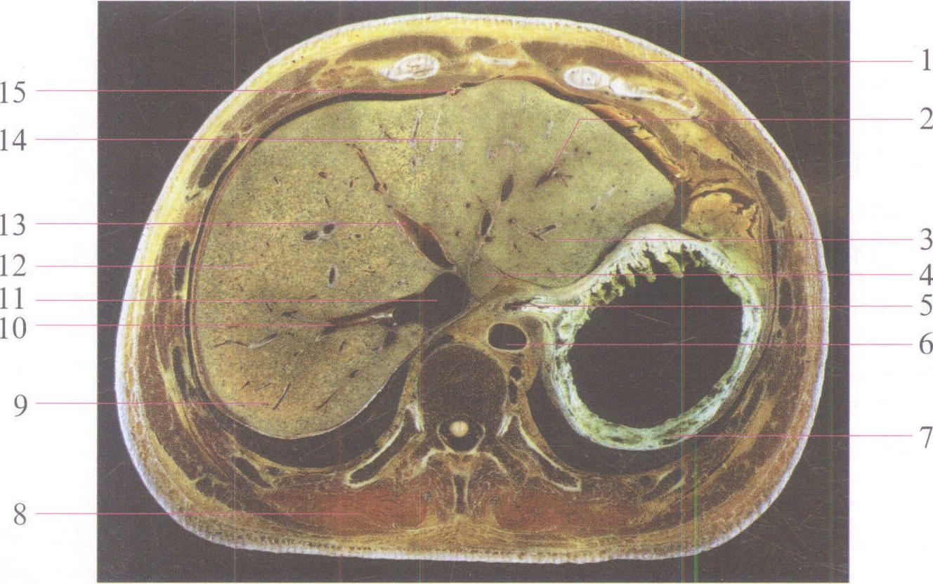 第二肝门横断面图片