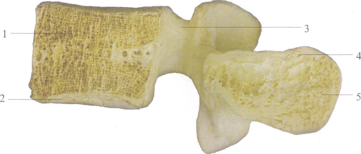 [临床解剖学要点]椎体的骨质,表层的骨密质较薄,内部的骨松质是其主体