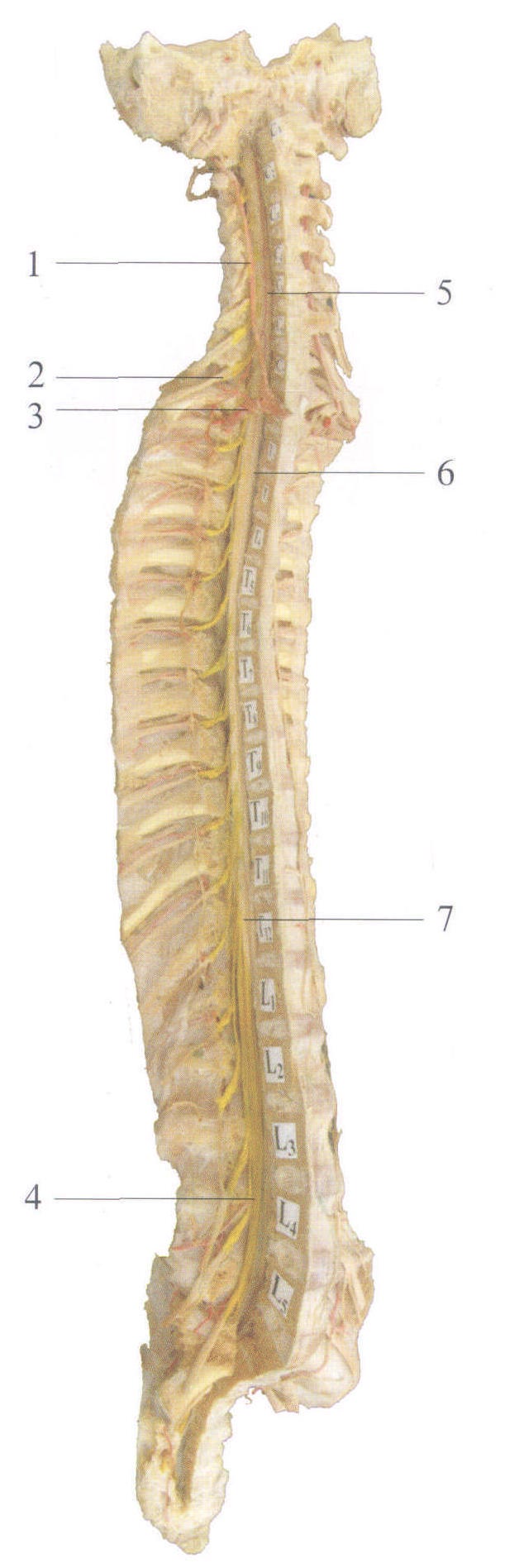 图2-55 脊柱和脊髓