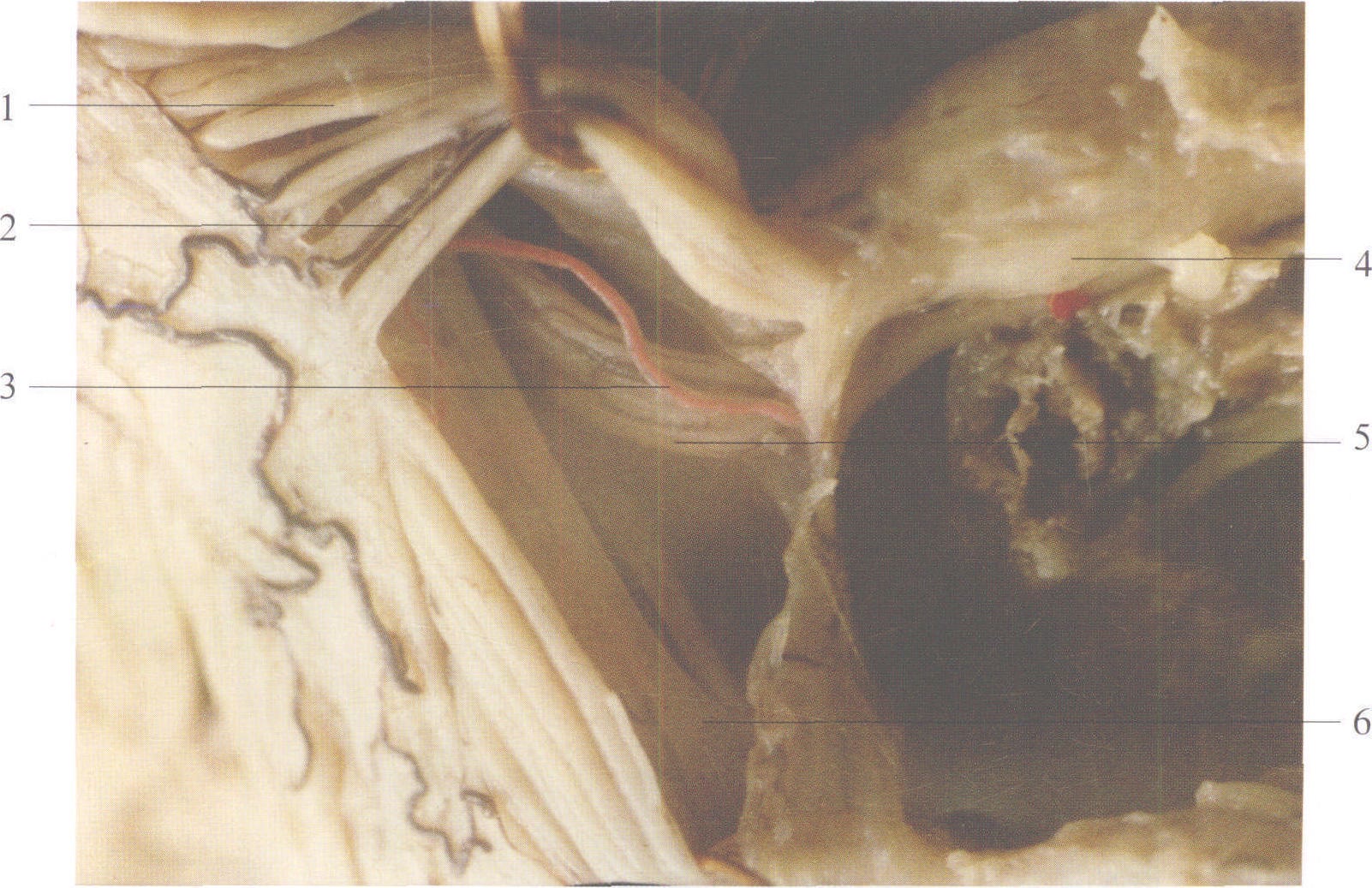 图2-64 齿状韧带和根动脉