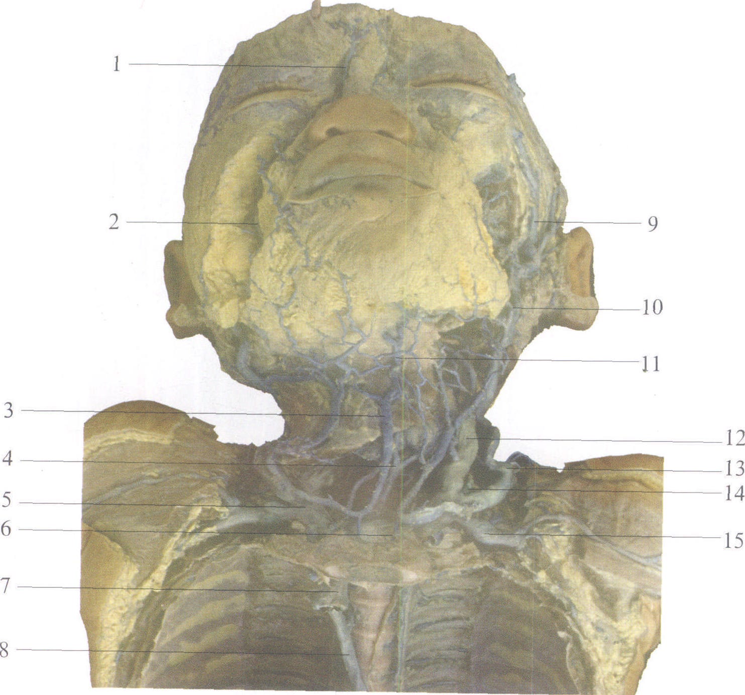 图2-130 头颈部的静脉
