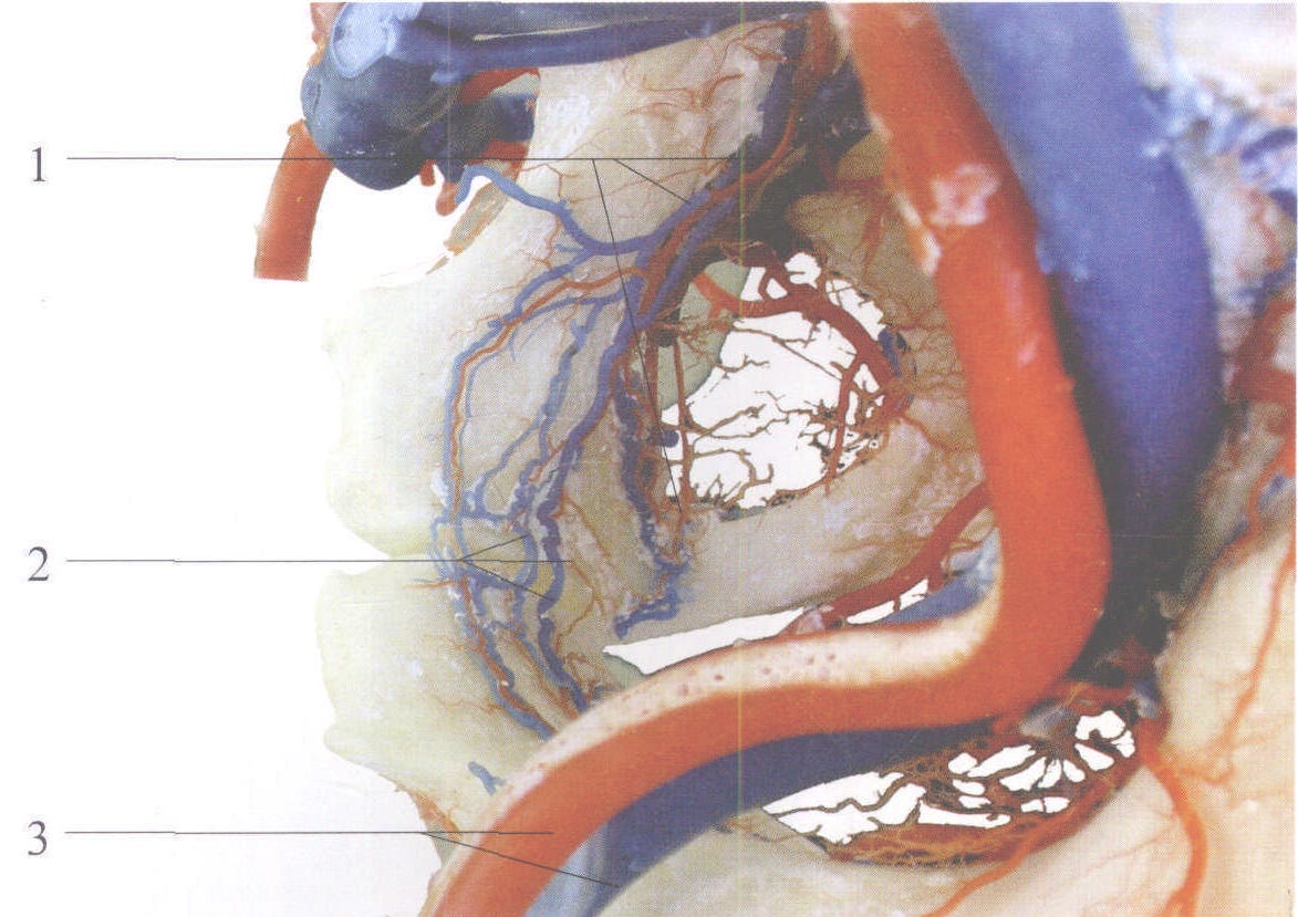 图2-257 闭孔动脉