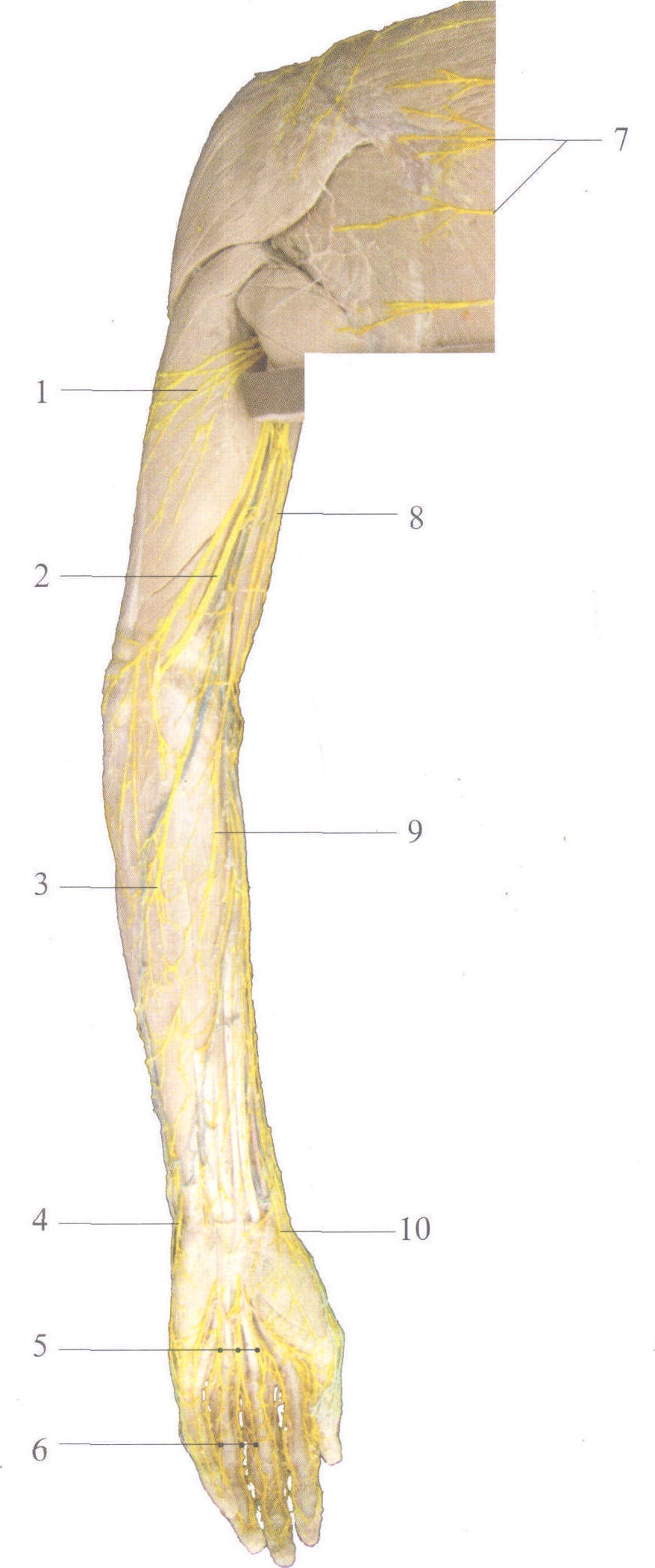 图3-11 上肢皮神经(后内面观)