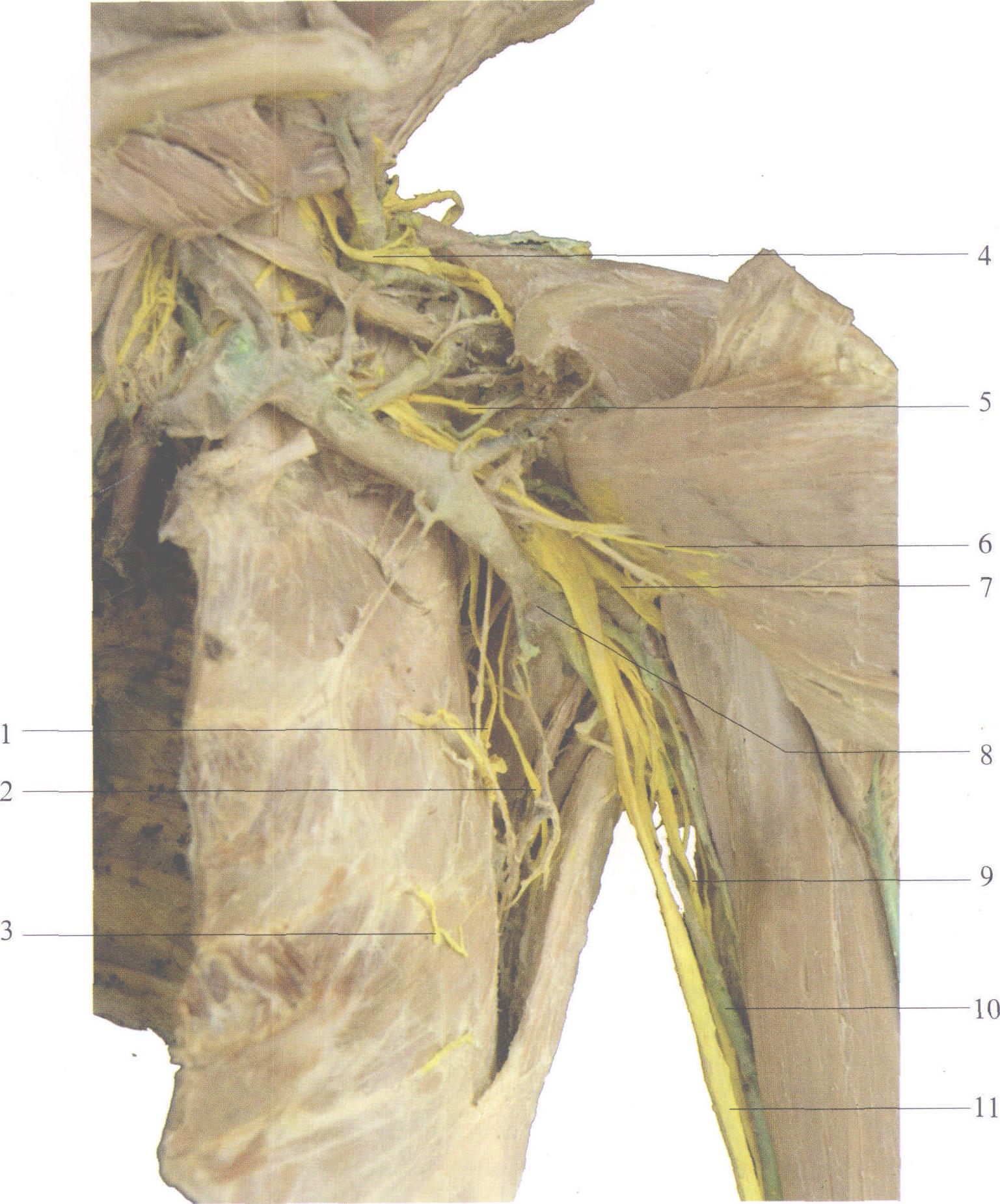 腋神经走行解剖图图图片