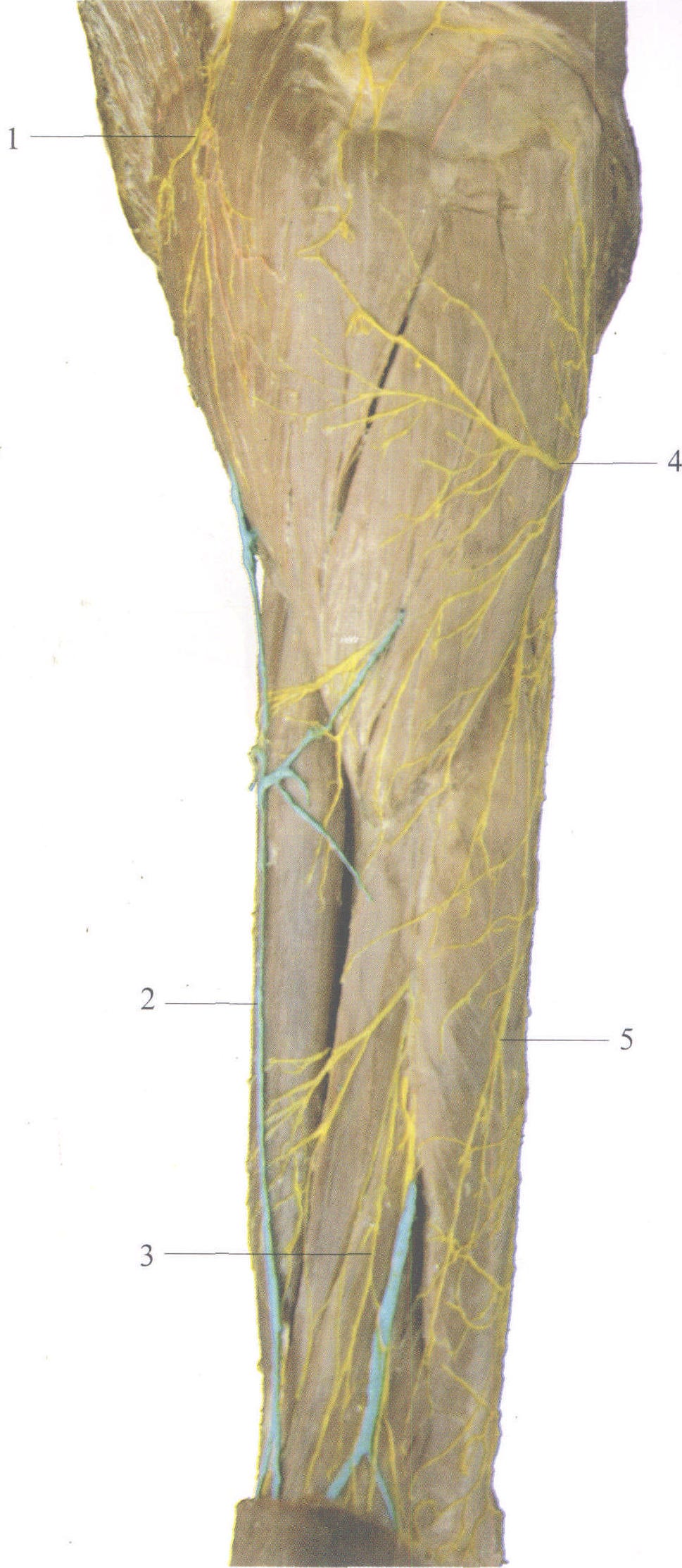 图3-59 臂外侧的皮神经(2)