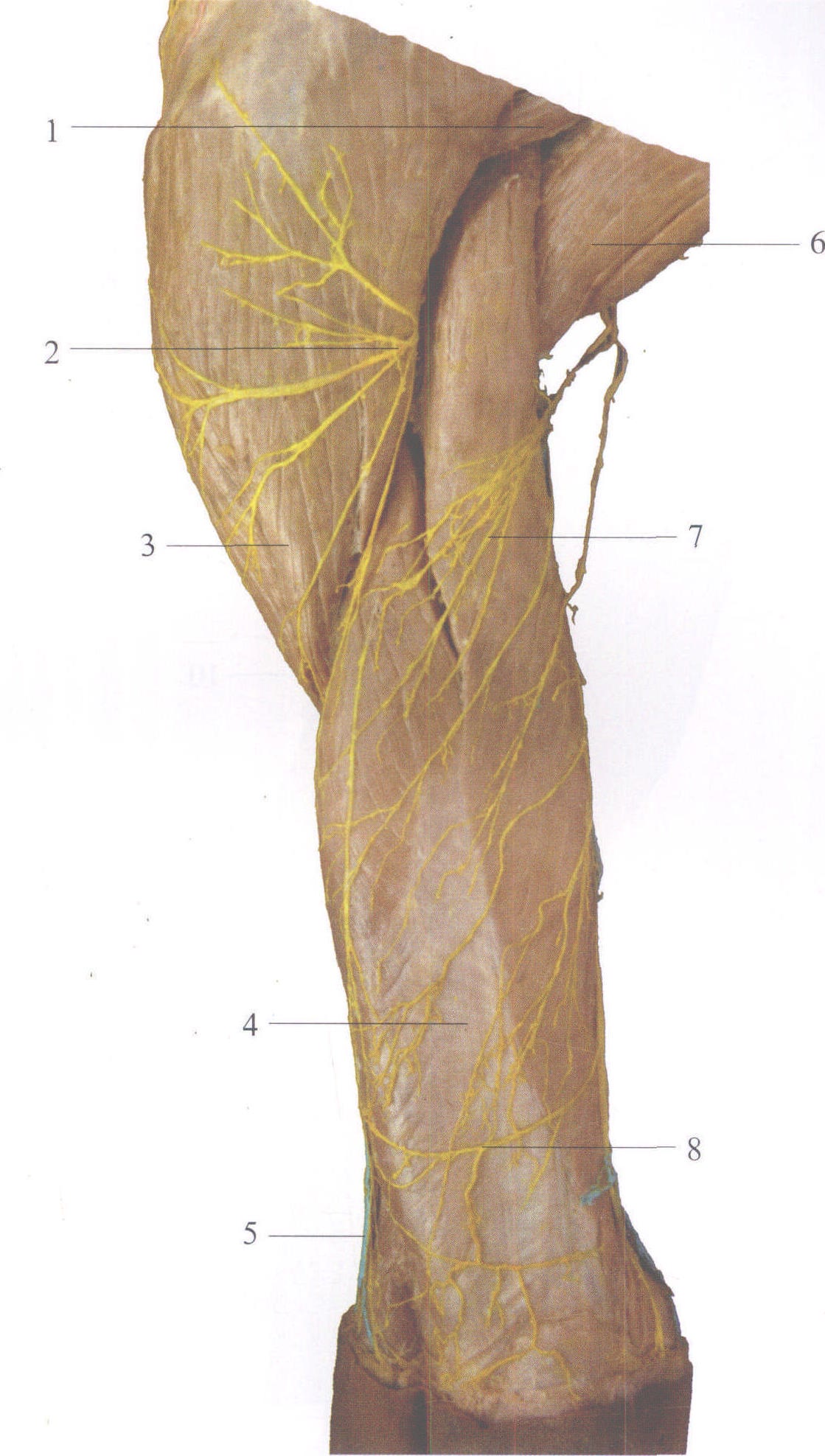 图3-61 臂后肌、血管和皮神经(1)