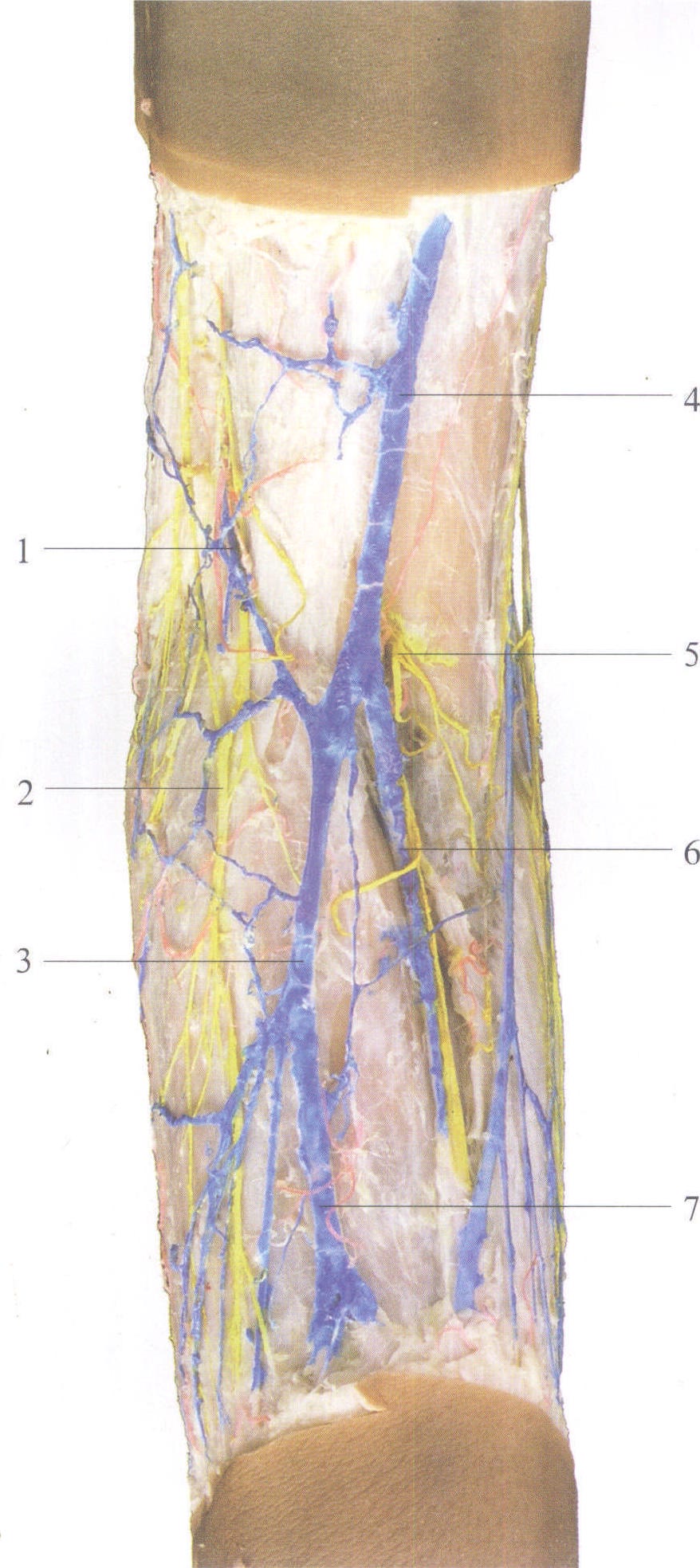 图3-80 肘前部的浅静脉和皮神经(1)