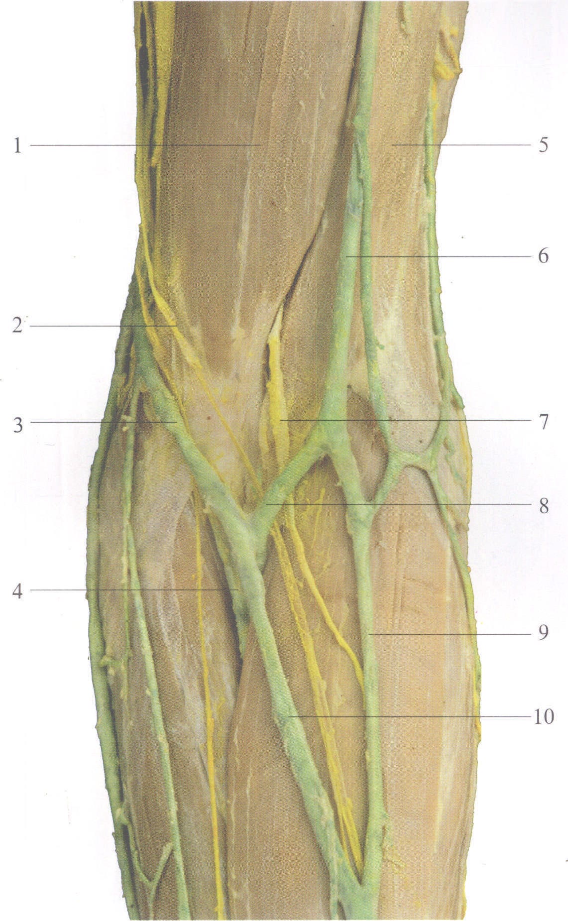 图3-82 肘前部的浅静脉和皮神经(3)
