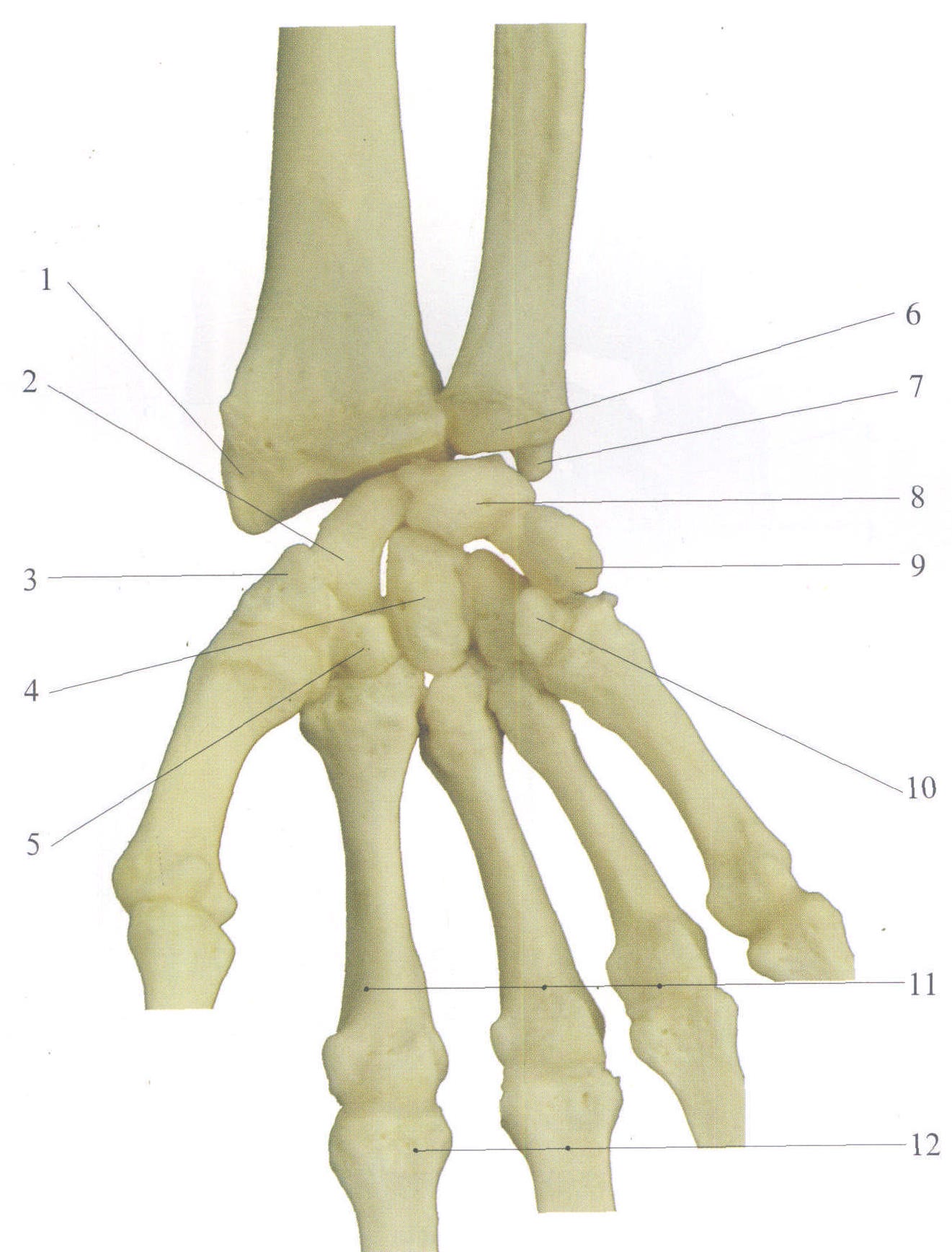 (图) 尺桡骨下端,腕骨和掌骨(前面观)