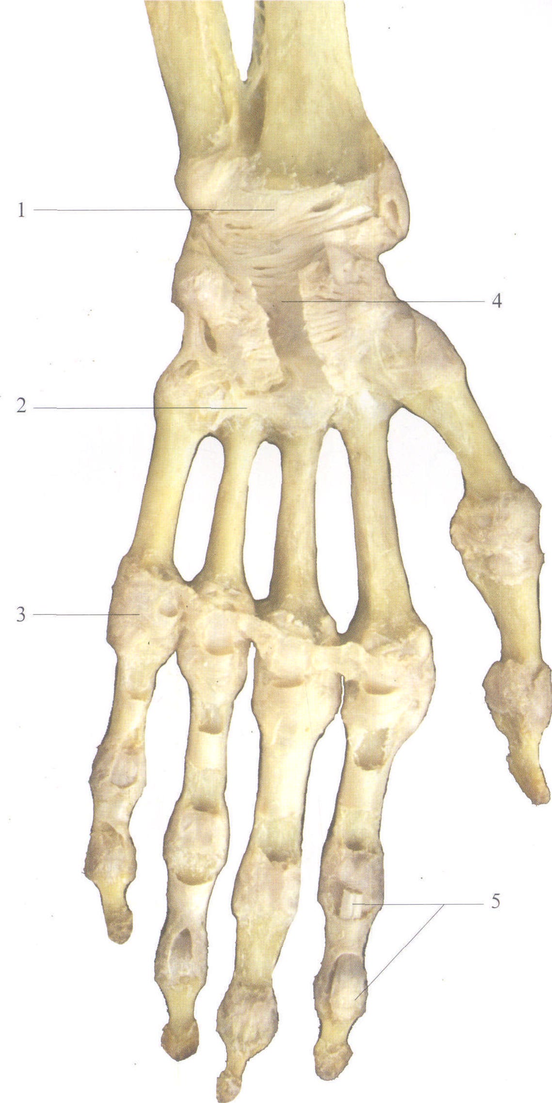 (图) 手的关节(前面观)