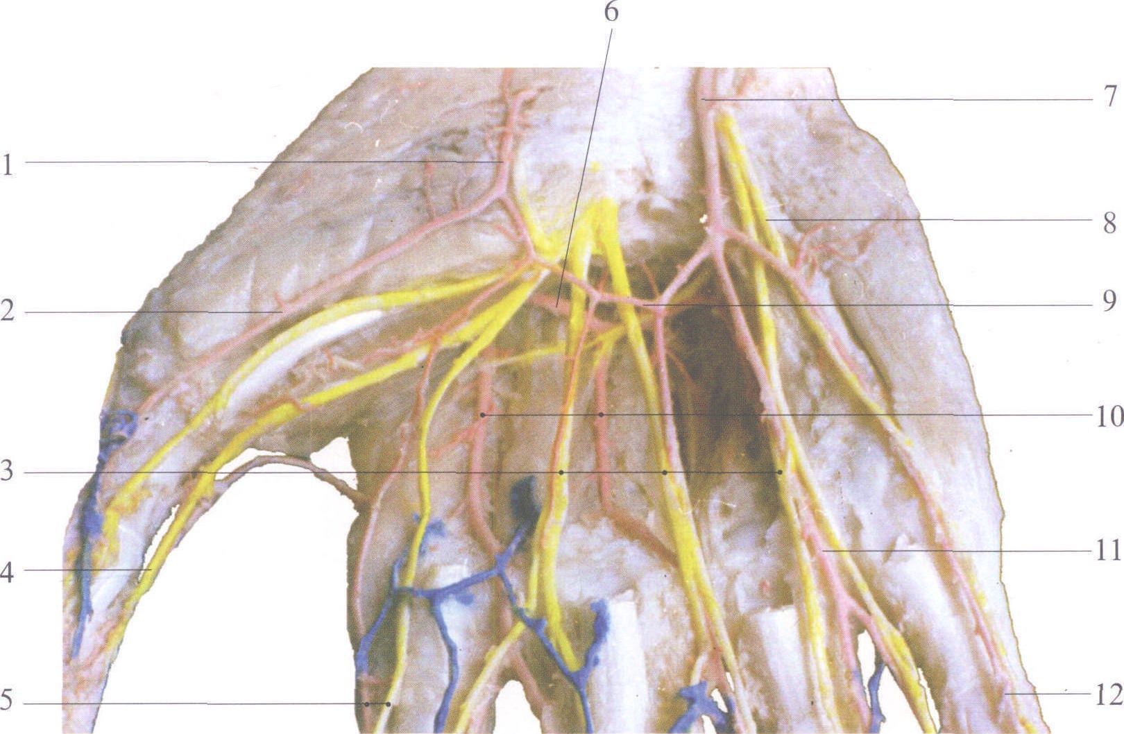 指掌侧总神经图片