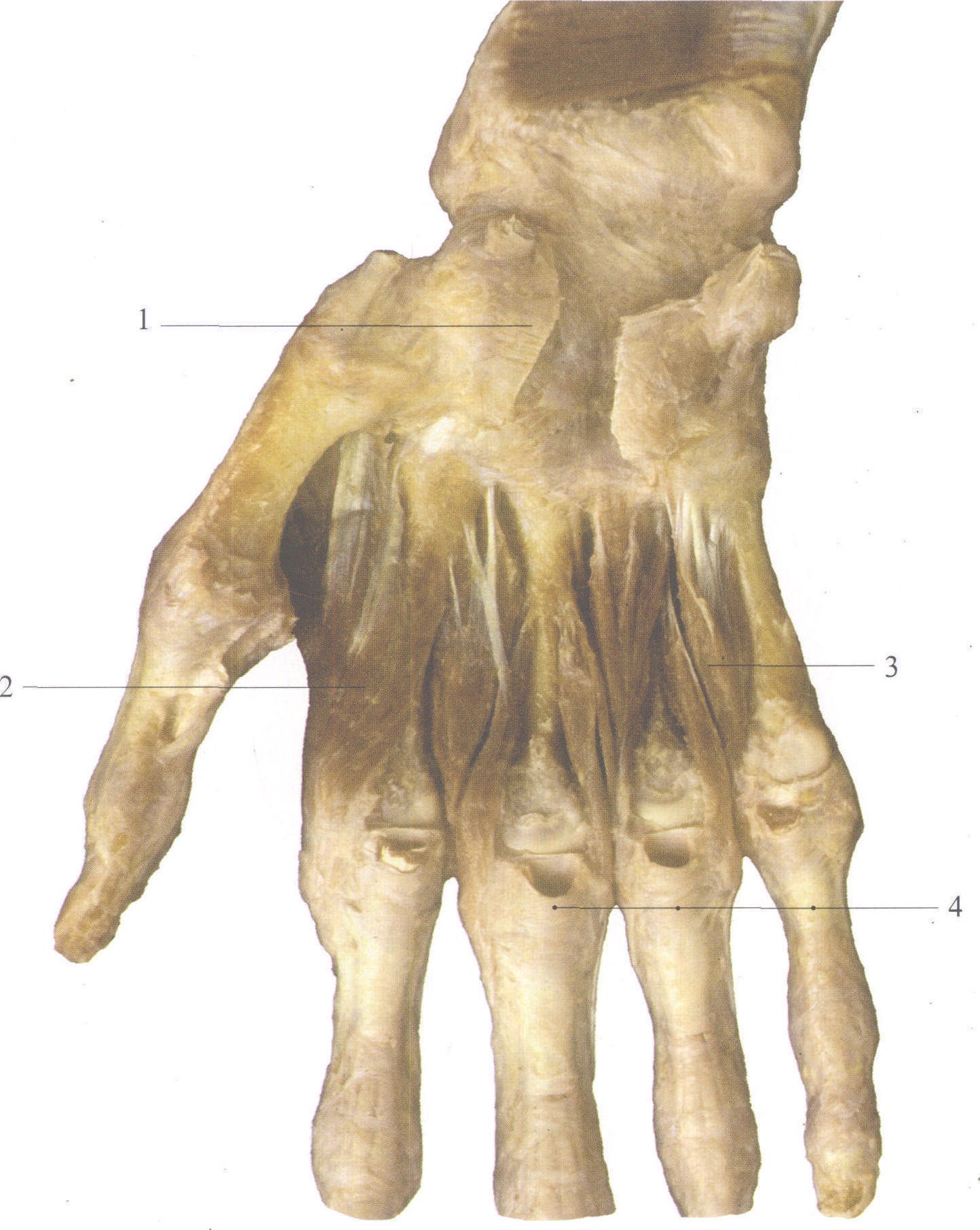 图  手掌部肌 2